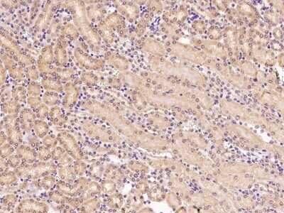 Immunohistochemistry-Paraffin: HuR/ELAVL1 Antibody [NBP2-98790]