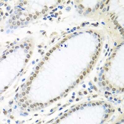 Immunohistochemistry-Paraffin: HuR/ELAVL1 Antibody - BSA Free [NBP3-02947]