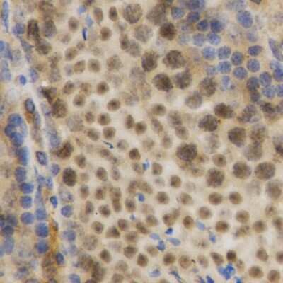 Immunohistochemistry-Paraffin: HuR/ELAVL1 Antibody - BSA Free [NBP3-03449]