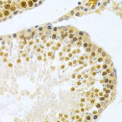 Immunohistochemistry-Paraffin: HuR/ELAVL1 Antibody - BSA Free [NBP3-03449]