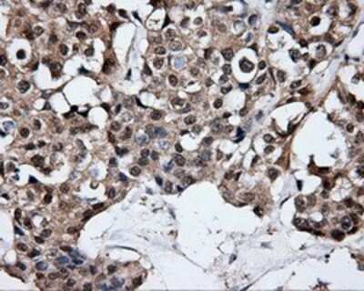 Immunohistochemistry: HuR/ELAVL1 Antibody (OTI14F4) - Azide and BSA Free [NBP2-70635]