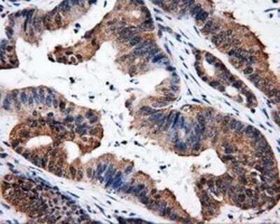 Immunohistochemistry: HuR/ELAVL1 Antibody (OTI14F4) - Azide and BSA Free [NBP2-70635]