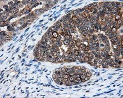 Immunohistochemistry: HuR/ELAVL1 Antibody (OTI14F4) - Azide and BSA Free [NBP2-70635]