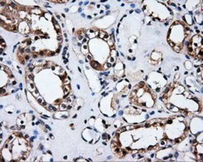 Immunohistochemistry: HuR/ELAVL1 Antibody (OTI14F4) - Azide and BSA Free [NBP2-70635]