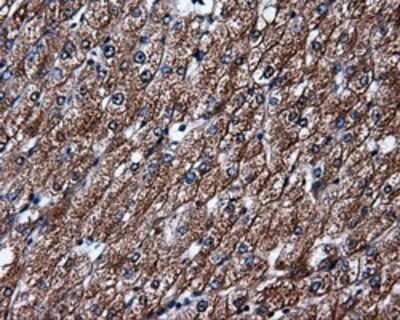 Immunohistochemistry: HuR/ELAVL1 Antibody (OTI14F4) - Azide and BSA Free [NBP2-70635]