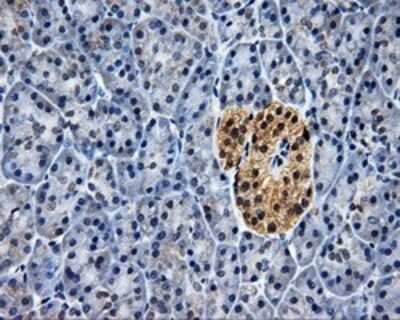 Immunohistochemistry: HuR/ELAVL1 Antibody (OTI14F4) - Azide and BSA Free [NBP2-70635]