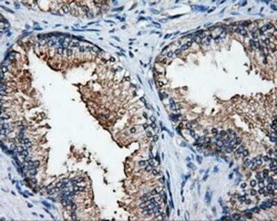 Immunohistochemistry: HuR/ELAVL1 Antibody (OTI14F4) - Azide and BSA Free [NBP2-70635]