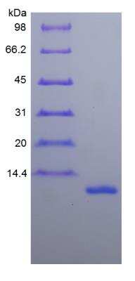 SDS-PAGE: Recombinant Human CCL11/Eotaxin Protein [NBP2-34976]