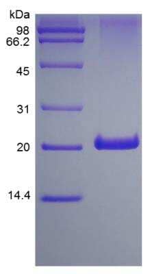 SDS-PAGE: Recombinant Human 4-1BB/TNFRSF9/CD137 Protein [NBP2-34958]