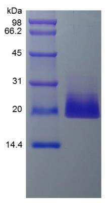 SDS-PAGE: Recombinant Human 4-1BB Ligand/TNFSF9 Protein [NBP2-34959]