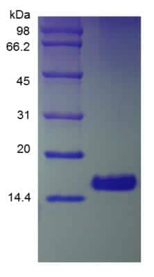 SDS-PAGE: Recombinant Human Amphiregulin Protein [NBP2-35055]