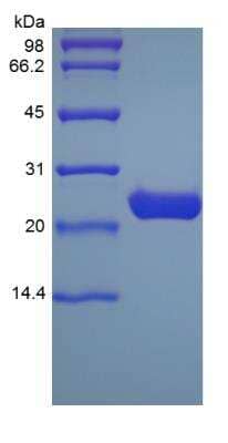 SDS-PAGE: Recombinant Human Apolipoprotein A-I/ApoA1 Protein [NBP2-34869]