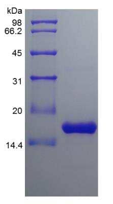 SDS-PAGE: Recombinant Human BAFF/BLyS/TNFSF13B Protein [NBP2-34883]