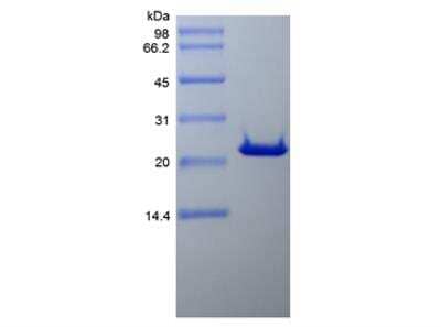 SDS-PAGE: Recombinant Human Bcl-2 Protein [NBP2-34889]