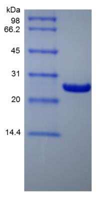 SDS-PAGE: Recombinant Human Bcl-xL Protein [NBP2-34899]