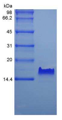 SDS-PAGE: Recombinant Human Betacellulin/BTC Protein [NBP2-34919]