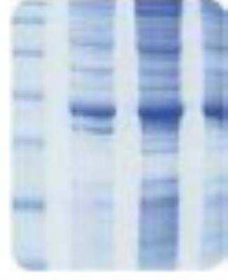 SDS-PAGE: Human Bladder Whole Tissue Lysate (Adult Whole Normal) [NB820-59173]