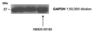 Western Blot: Human Brain Cerebral Meninges Whole Tissue Lysate (Adult Whole Normal) [NB820-59183]