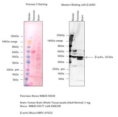 Western Blot: Human Brain Whole Tissue Lysate (Adult Whole Normal) [NB820-59177]