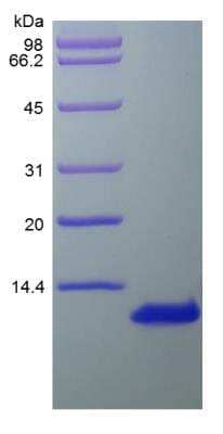 SDS-PAGE: Recombinant Human CCL1/I-309/TCA-3 Protein [NBP2-35886]