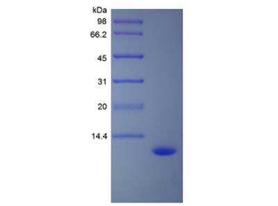 SDS-PAGE: Recombinant Human CCL15/MIP-1 delta Protein [NBP2-35065]