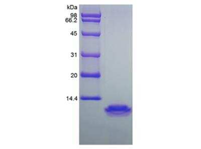 SDS-PAGE: Recombinant Human CCL18/PARC Protein [NBP2-35041]