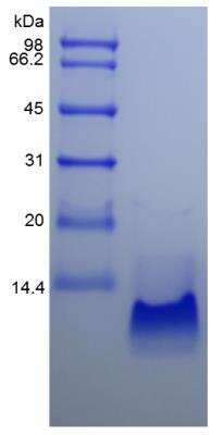 SDS-PAGE: Recombinant Human CCL20/MIP-3 alpha Protein [NBP2-35025]