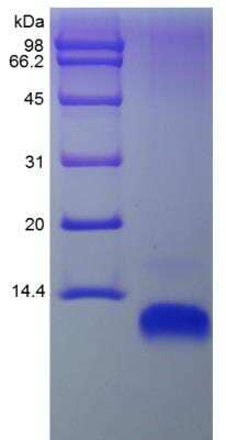 SDS-PAGE: Recombinant Human CCL22/MDC Protein [NBP2-34977]