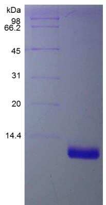 SDS-PAGE: Recombinant Human CCL23/Ck beta 8-1/MIP3 Protein [NBP2-35021]