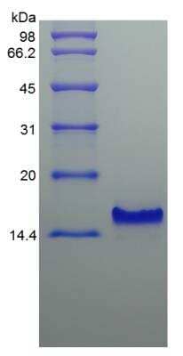 SDS-PAGE: Recombinant Human CCL25/TECK Protein [NBP2-35039]