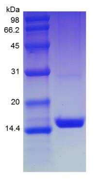 SDS-PAGE: Recombinant Human CCL28 Protein [NBP2-34983]