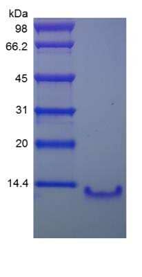 SDS-PAGE: Recombinant Human CCL4L1/LAG-1 Protein [NBP2-34929]