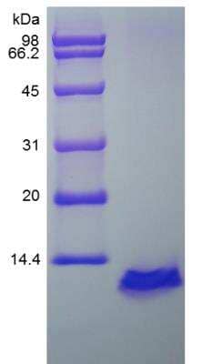 SDS-PAGE: Recombinant Human CCL5/RANTES Protein [NBP2-35235]