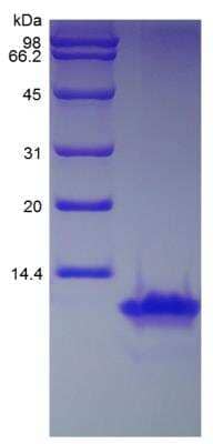 SDS-PAGE: Recombinant Human CCL8/MCP-2 Protein [NBP2-34969]