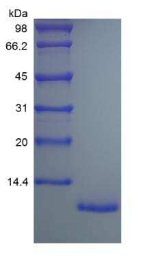 SDS-PAGE: Recombinant Human CX3CL1/Fractalkine Protein [NBP2-34874]