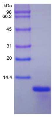 SDS-PAGE: Recombinant Human CXCL1/GRO alpha/KC/CINC-1 Protein [NBP2-34904]