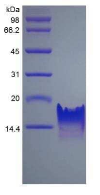 SDS-PAGE: Recombinant Human CXCL11/I-TAC Protein [NBP2-34922]