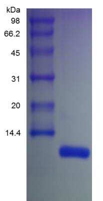 SDS-PAGE: Recombinant Human CXCL12/SDF-1 beta Protein [NBP2-35260]