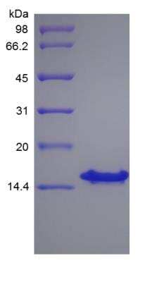 SDS-PAGE: Recombinant Human CXCL12/SDF-1 gamma Protein [NBP2-35262]