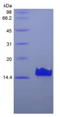 SDS-PAGE: Recombinant Human CXCL17/VCC-1 Protein [NBP2-35133]