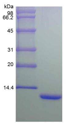 SDS-PAGE: Recombinant Human CXCL8/IL-8 Protein [NBP2-34905]