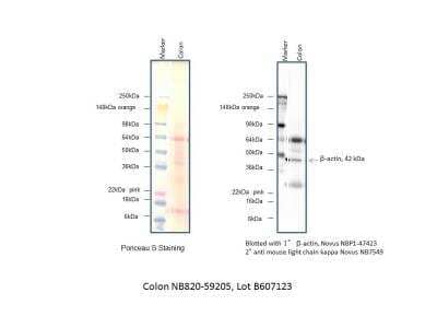 Western Blot: Human Colon Whole Tissue Lysate (Adult Whole Normal) [NB820-59205]