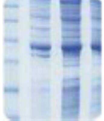 SDS-PAGE: Human Colon Whole Tissue Lysate (Adult Whole Normal) [NB820-59205]