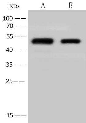 Western Blot: Human Coronavirus Nucleocapsid Protein Antibody [NBP3-12766]