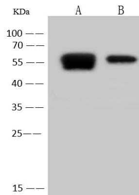 Western Blot: Human Coronavirus Nucleocapsid Protein Antibody [NBP3-12768]