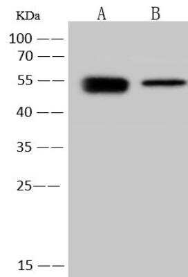 Western Blot: Human Coronavirus Nucleocapsid Protein Antibody [NBP3-12769]