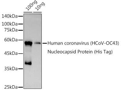 Western Blot: Human Coronavirus Nucleocapsid Protein AntibodyAzide and BSA Free [NBP3-16059]