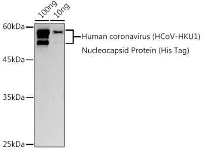 Western Blot: Human Coronavirus Nucleocapsid Protein AntibodyAzide and BSA Free [NBP3-16060]