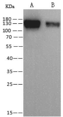 Western Blot: Human Coronavirus Spike Protein Antibody (07) [NBP3-06647]