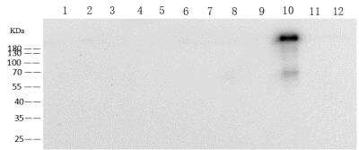 Western Blot: Human Coronavirus Spike Protein Antibody (10) [NBP3-14652]